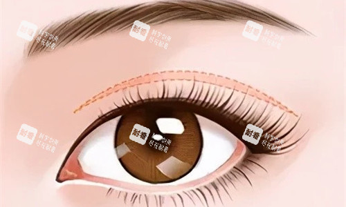 双眼皮特写展示图.jpg