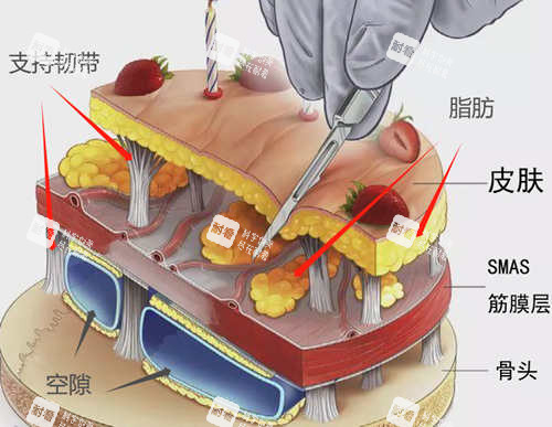 SMAS筋膜层.jpg