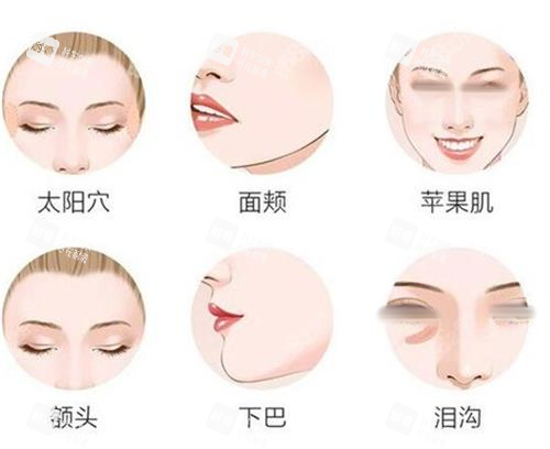 面部填充部位一览图.png