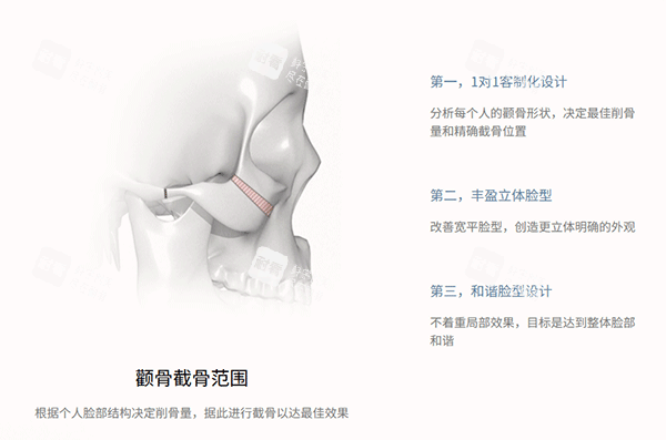 韩国345整形面部轮廓手术.png 韩国345整形面部轮廓手术.png