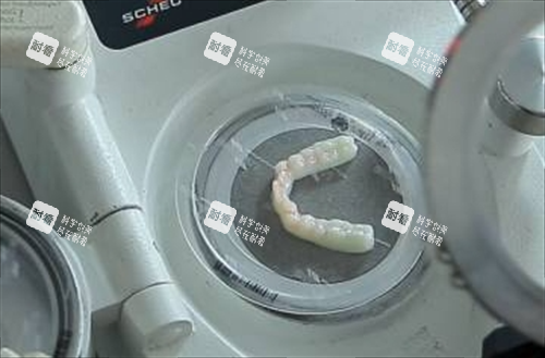 隐形矫正制模过程.png 隐形矫正制模过程.png
