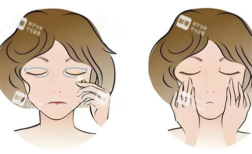去眼袋前后对比动画图.png