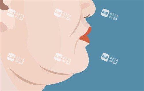 双下巴的样子卡通图.jpg