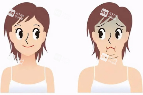双下巴消除卡通对比图.jpg