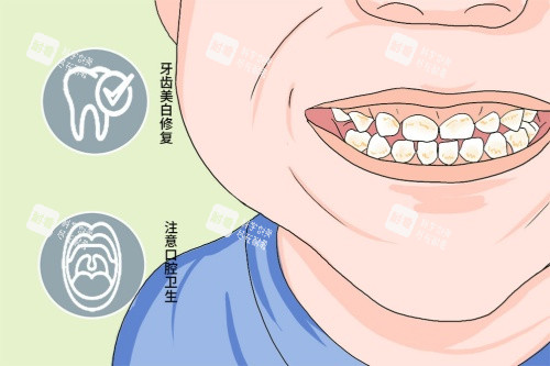 四环素牙卡通图.jpg 四环素牙卡通图.jpg