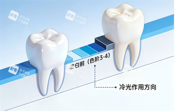 牙齿冷光美白前后治疗示意图.jpg 牙齿冷光美白前后治疗示意图.jpg