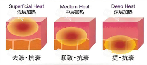 热拉提分层作用.jpg