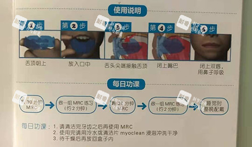 牙齿矫正MRC早期肌功能矫正说明.jpg