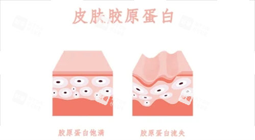 胶原蛋白在皮肤表面的动画示意图.png 胶原蛋白在皮肤表面的动画示意图.png