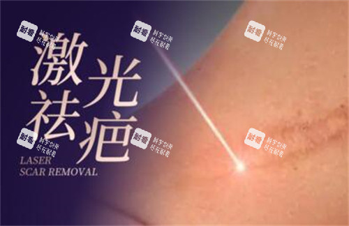 激光祛疤改善照片.jpg