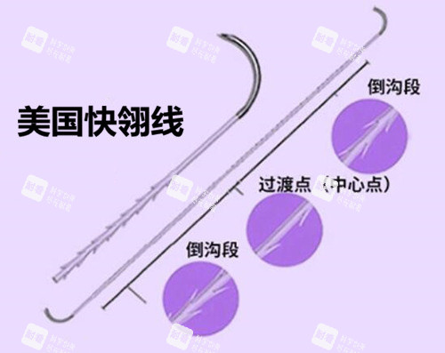 美国快翎线.jpg 美国快翎线.jpg