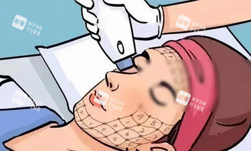 热玛吉的动画操作图.jpg