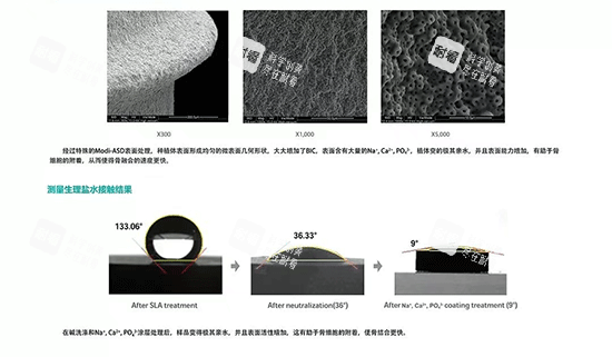 韩国inno伊诺种植牙好不好.png 韩国inno伊诺种植牙好不好.png