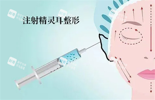 精灵耳注射动画图.jpg