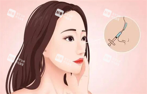 注射隆鼻卡通图.jpg