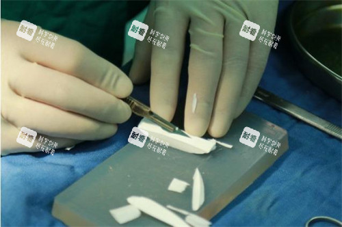 隆鼻手术正在雕刻的膨体.jpg