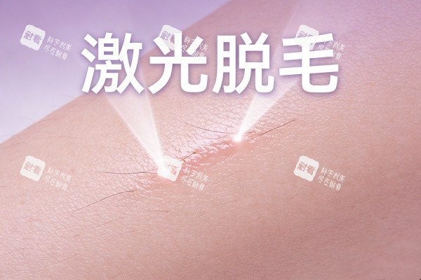 激光脱毛卡通展示图.jpg