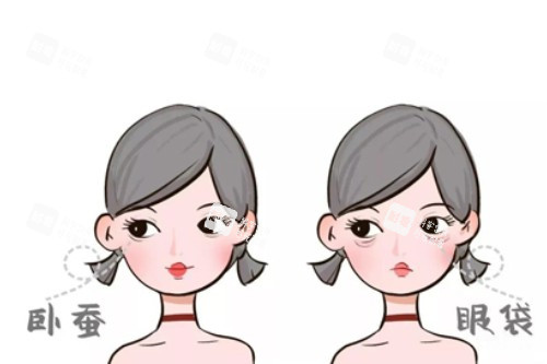 卧蚕、眼袋卡通对比图.jpg