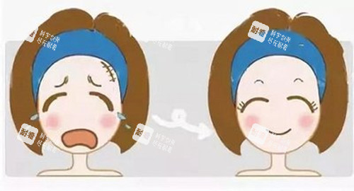 激光美容前后对比卡通示意图.jpg 激光美容前后对比卡通示意图.jpg