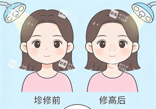 鼻修复前后的对比.png