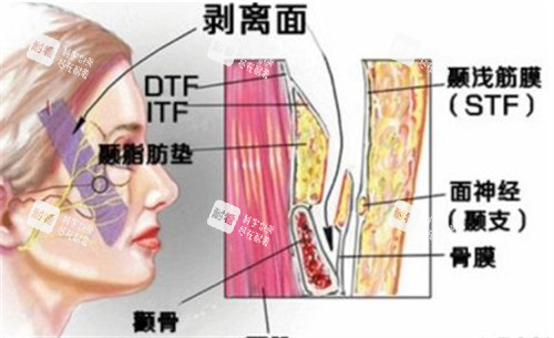 面部层次图解.jpg 面部层次图解.jpg
