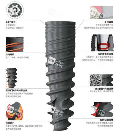 百齿泰泰锆3.0种植牙怎么样.jpg