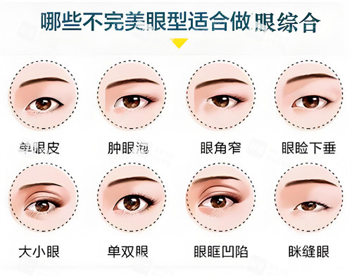 哪些眼型适合做眼综合示例动画图.jpg 哪些眼型适合做眼综合示例动画图.jpg