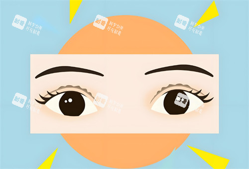 双眼皮睁开图.jpg 双眼皮睁开图.jpg