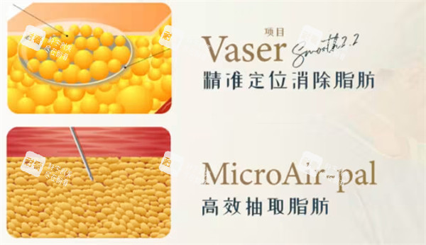 吸脂多少钱.jpg