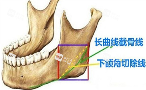 下颌角所在位置.jpg 下颌角所在位置.jpg