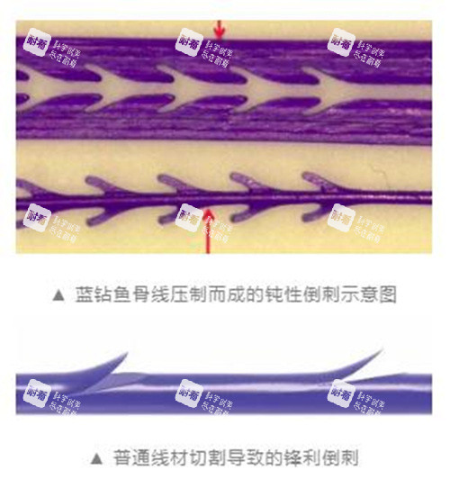 蓝钻鱼骨线.jpg 蓝钻鱼骨线.jpg