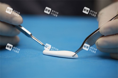 隆鼻手术中使用的膨体.jpg 隆鼻手术中使用的膨体.jpg
