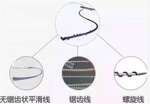 埋线提升不同类型的线.jpg