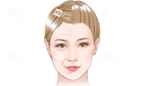 面部抗衰老的意义.jpg 面部抗衰老的意义.jpg
