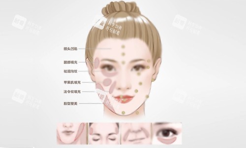 填充部位示意图.jpg