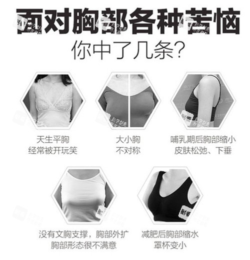 胸部整形适应症.jpg