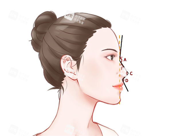鼻尖塑形.png