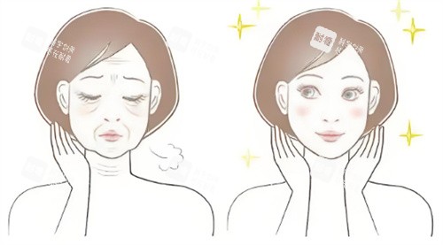 脸部抗衰前后对比.jpg