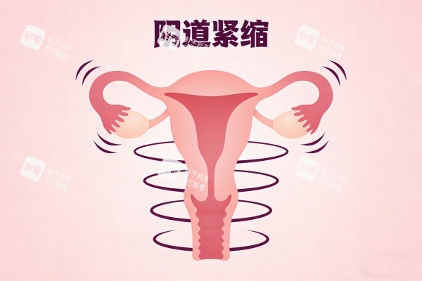 阴道紧缩卡通图展示.jpg 阴道紧缩卡通图展示.jpg