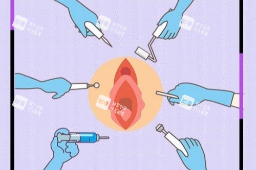私密整形卡通图.jpg 私密整形卡通图.jpg