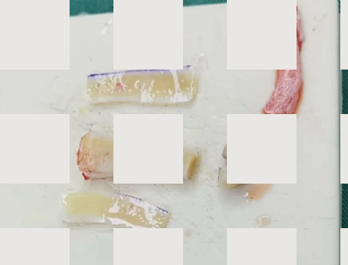 肋骨隆鼻材料.png