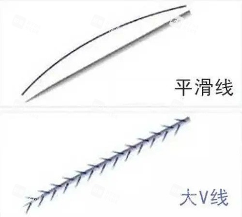 大V线图片.jpg 大V线图片.jpg