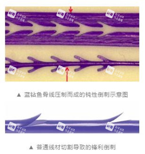 蓝钻鱼骨线.jpg