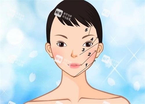 线提升.jpg 线提升.jpg