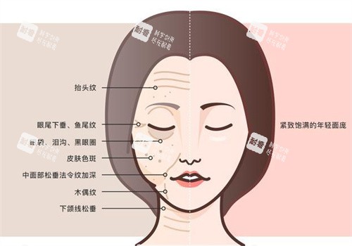 面部抗衰前后.jpg 面部抗衰前后.jpg