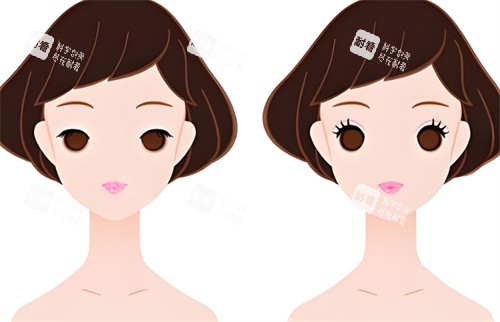 双眼皮前后对比图.jpg 双眼皮前后对比图.jpg