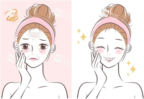 抗衰管理前后的对比图片.jpg 抗衰管理前后的对比图片.jpg