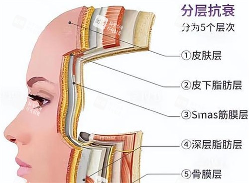 分层抗衰好不好.jpg 分层抗衰好不好.jpg