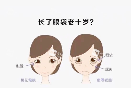 祛眼袋.webp.jpg
