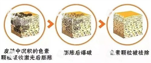 超皮秒原理.jpg 超皮秒原理.jpg